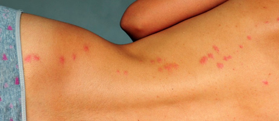 Les parasites Archives SAB Service Antiparasitaire de